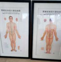Sem Autoria - Dois affiches didáticos sobre acupuntura, oficiais do governo da República Popular da China, c.1990, 1,38 m x 0,88 m, emoldurados